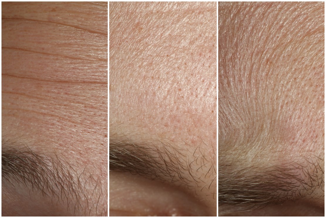 human skin texture map